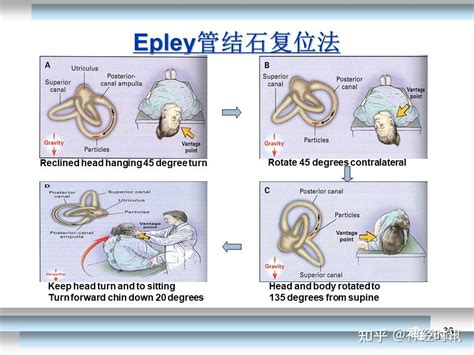 耳石復位法 水仙 意味